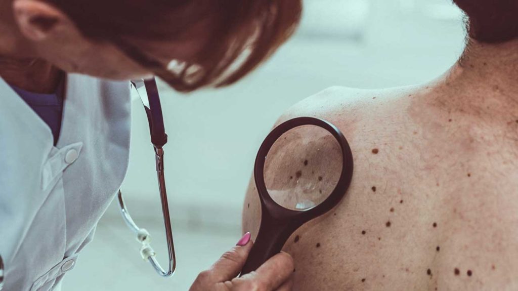 AI May Be Better at Detecting Skin Cancer Than Your Derm